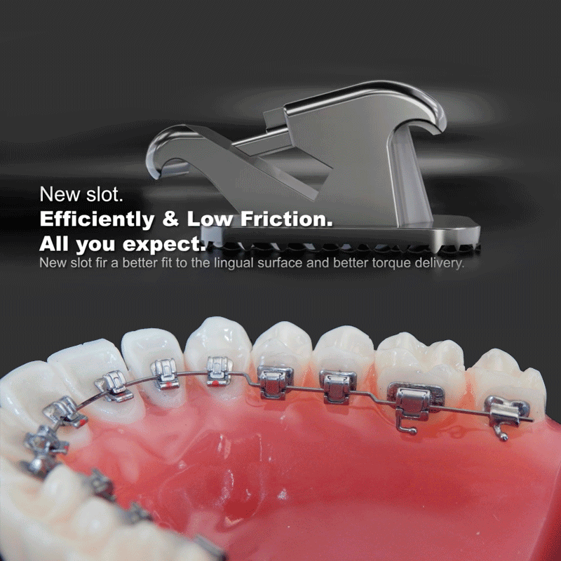 Kit Bracket Autoligado Lingual InTendo Ortotek