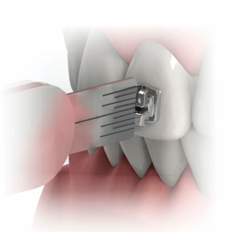 Pinza para Brackets 13 cms. Morelli Ortotek