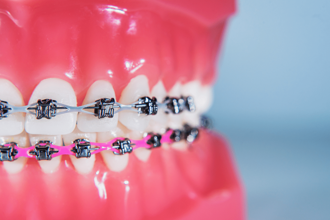 cadeneta de brackets