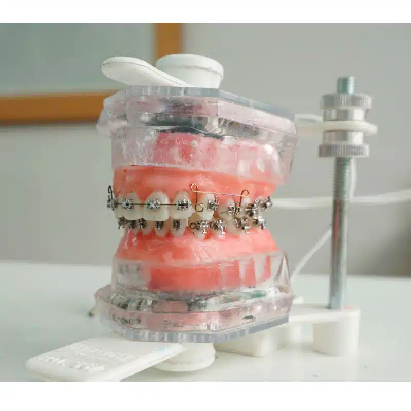 Tipodonto Electrónico | Grinendent - Imagen 3