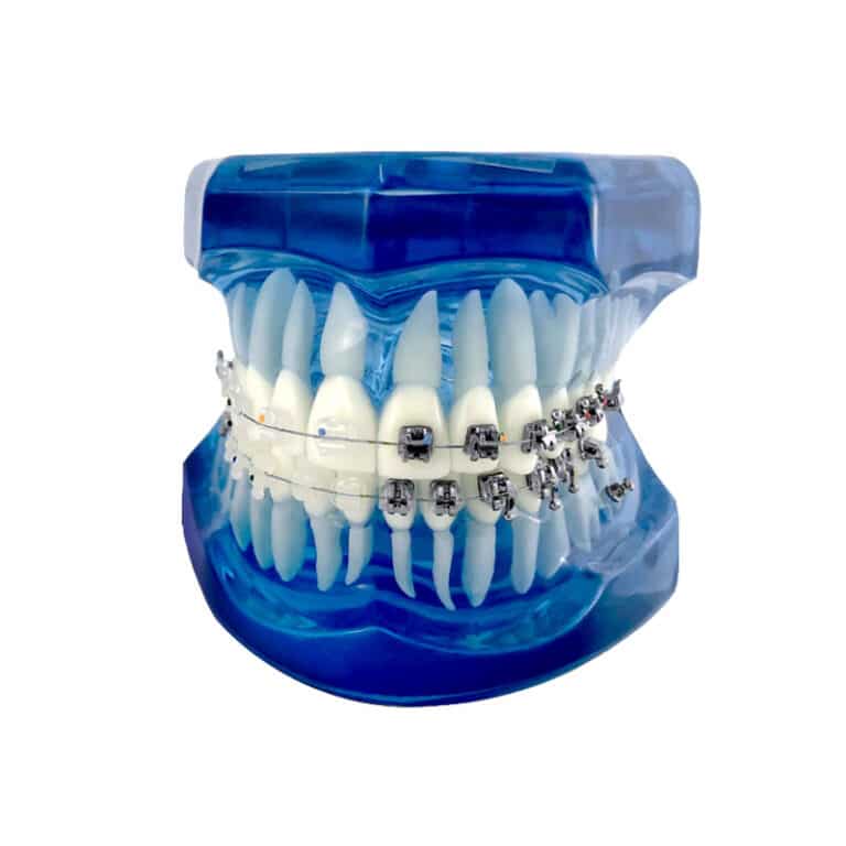 Modelo didáctico con brackets Morelli Ortotek