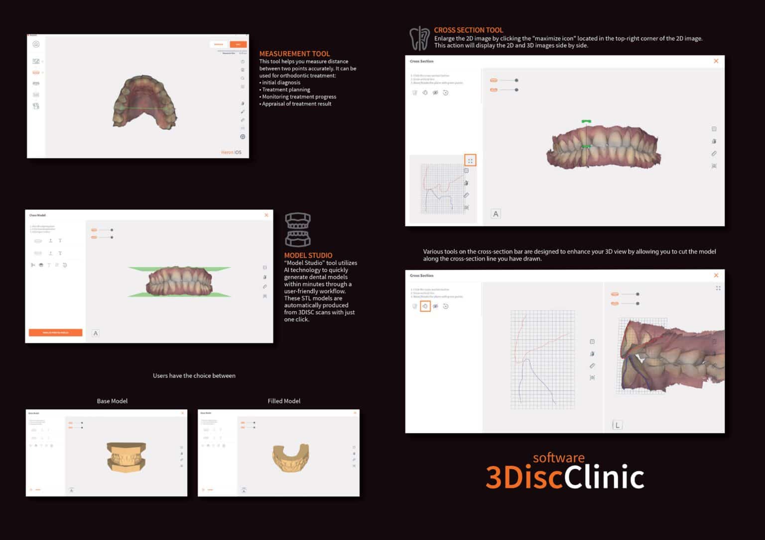Escáner Intraoral OVO | 3Disc - Ortotek